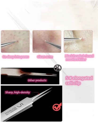 Professional Blackhead Remover